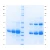 Immunoglobulin G, Light Chain