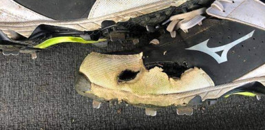 What do your toes look like?