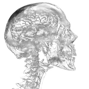 Metallic X-Ray Skull Vinyl Car Decal Sticker – Waterproof & UV-Resistant 8"