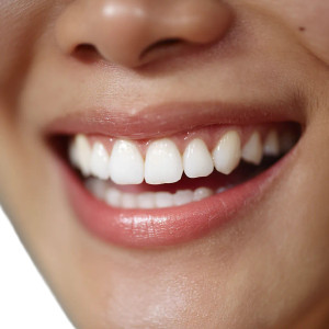 Smiling Teeth Close-Up Vinyl Car Decal Sticker – Waterproof & UV-Resistant 8"