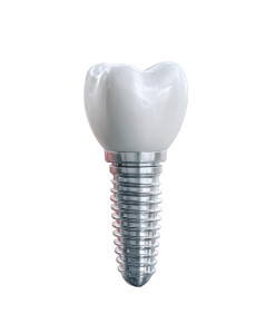 Dental Implant Vinyl Car Decal Sticker – Waterproof & UV-Resistant 8" Dental Implant Vinyl Car Decal Sticker – Waterproof & UV-Resistant 8"