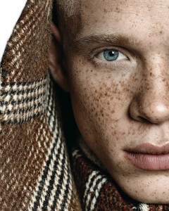 Albino African Portrait Vinyl Car Decal Sticker – Waterproof & UV-Resistant 