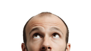 Confused Bald Man Vinyl Car Decal Sticker – Waterproof & UV-Resistant 