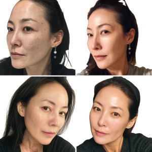 Skin Transformation Journey Vinyl Car Decal Sticker – Waterproof & UV-Resistant 