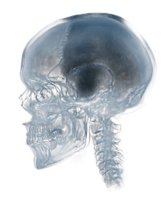 Human Skull X-Ray V2 Vinyl Car Decal Sticker – Waterproof & UV-Resistant 