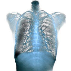 Chest X-Ray V2 Vinyl Car Decal Sticker – Waterproof & UV-Resistant 