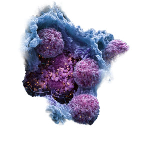 Nsclc Microscopic View Vinyl Car Decal Sticker – Waterproof & UV-Resistant 3.4133333333333336"