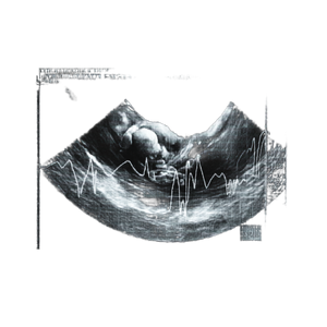 Sonogram Image Vinyl Car Decal Sticker – Waterproof & UV-Resistant 3.4133333333333336"