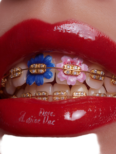 Golden Braced Lips Vinyl Car Decal Sticker – Waterproof & UV-Resistant 4.1066666666666665"