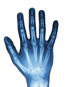 X-Ray Hand V2 Vinyl Car Decal Sticker – Waterproof & UV-Resistant 8.213333333333333"