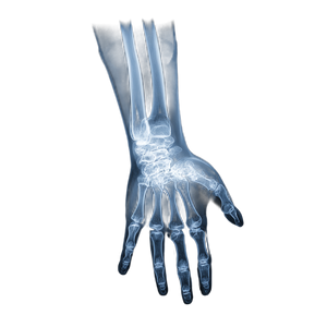 X-Ray Broken Bone Vinyl Car Decal Sticker – Waterproof & UV-Resistant 3.4133333333333336"