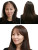 Hair Transplant Results Vinyl Car Decal Sticker – Waterproof & UV-Resistant 8"