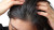 Dandruff Hair Vinyl Car Decal Sticker – Waterproof & UV-Resistant 