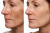 Skin Condition Comparison Vinyl Car Decal Sticker – Waterproof & UV-Resistant 