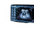Pregnancy Ultrasound Vinyl Car Decal Sticker – Waterproof & UV-Resistant 