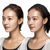Earlobe Filler Comparison Vinyl Car Decal Sticker – Waterproof & UV-Resistant 6.826666666666667"
