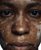 Vitiligo Portrait V2 Vinyl Car Decal Sticker – Waterproof & UV-Resistant 4.0"