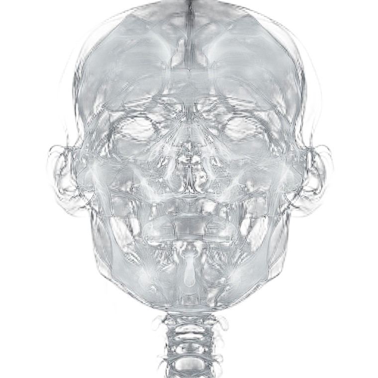 X-Ray Face Vinyl Car Decal Sticker – Waterproof & UV-Resistant 8"