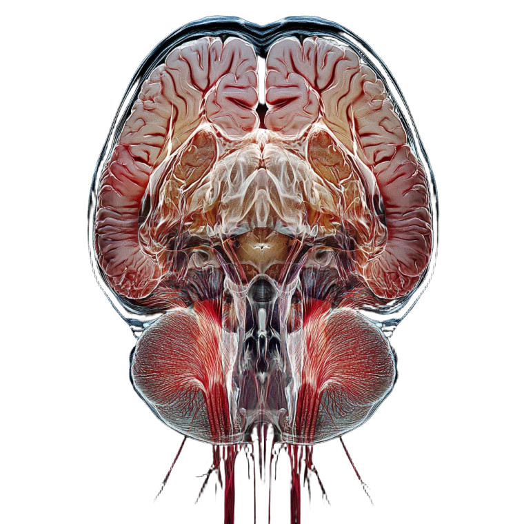 Detailed Mri Brain Vinyl Car Decal Sticker – Waterproof & UV-Resistant 8"