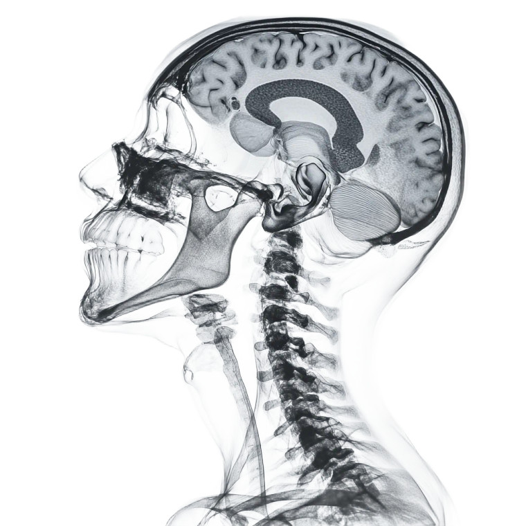 X-Ray Head Scan Vinyl Car Decal Sticker – Waterproof & UV-Resistant 8"