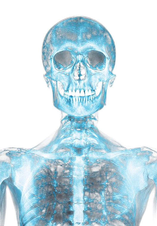 Human Skeleton X-Ray V2 Vinyl Car Decal Sticker – Waterproof & UV-Resistant 8"