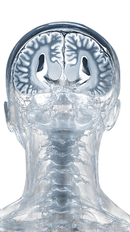 Mri Scan Head Vinyl Car Decal Sticker – Waterproof & UV-Resistant 8"