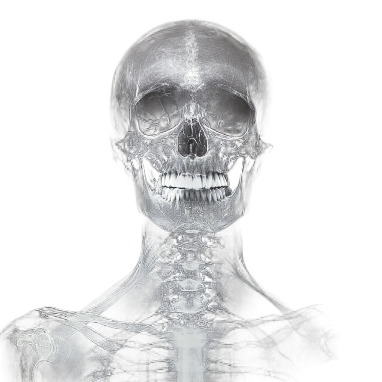 X-Ray Skull Portrait Vinyl Car Decal Sticker – Waterproof & UV-Resistant 8"