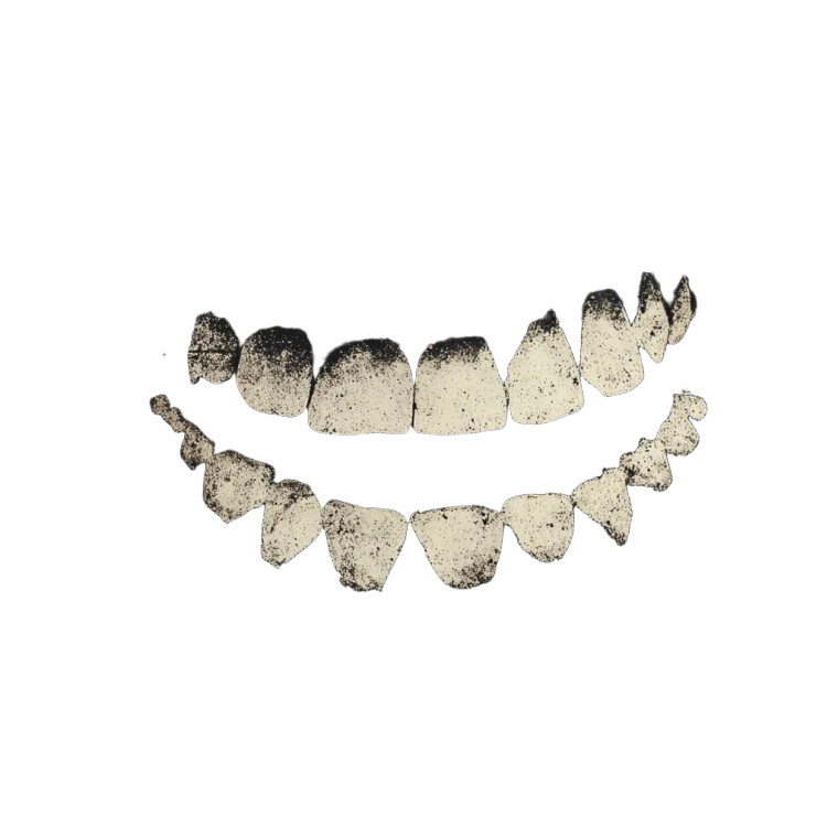 Crooked Teeth Smile V2 Vinyl Car Decal Sticker – Waterproof & UV-Resistant 8"