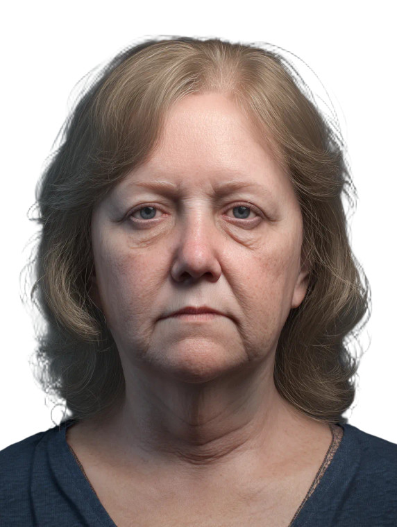 Diabetic Patient Portrait Vinyl Car Decal Sticker – Waterproof & UV-Resistant  Diabetic Patient Portrait Vinyl Car Decal Sticker – Waterproof & UV-Resistant