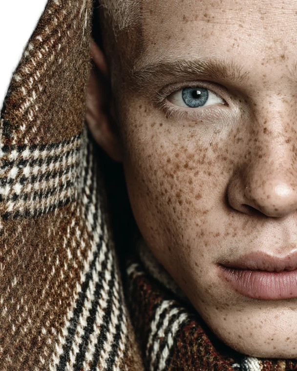 Albino African Portrait Vinyl Car Decal Sticker – Waterproof & UV-Resistant 