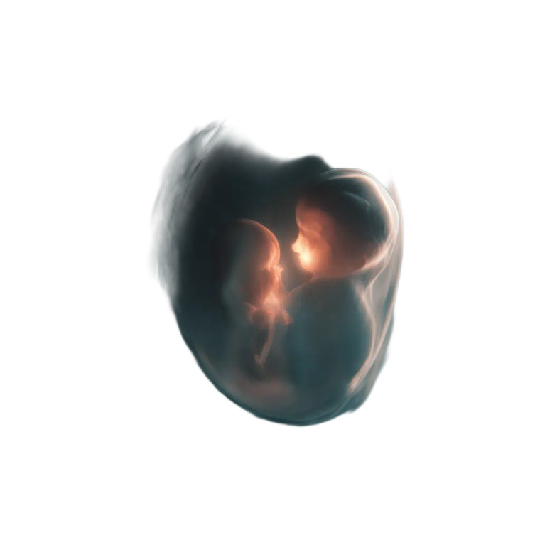Glowing Fetus Twin Vinyl Car Decal Sticker – Waterproof & UV-Resistant 