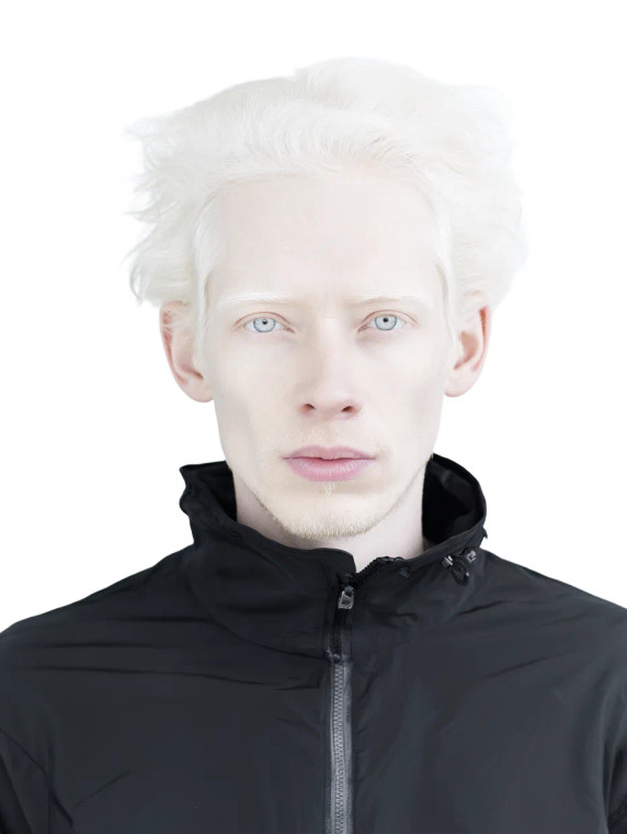 Albino Man Portrait Vinyl Car Decal Sticker – Waterproof & UV-Resistant 