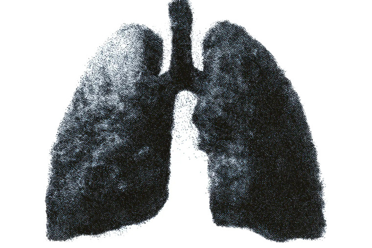 Halftone Human Lung Vinyl Car Decal Sticker – Waterproof & UV-Resistant 