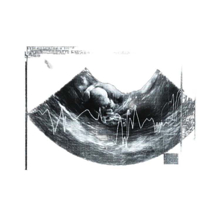 Sonogram Image Vinyl Car Decal Sticker – Waterproof & UV-Resistant 3.4133333333333336"