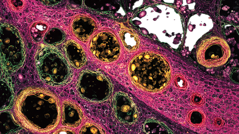 Cell Pathology Slide Vinyl Car Decal Sticker – Waterproof & UV-Resistant 5.4