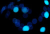 Blue Bokeh II Poster Print by Erin Berzel - Item # VARPDXPSBZL568