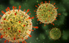 Microscopic view of herpes virus Poster Print - Item # VARPSTSTK700949H