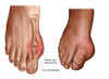 Anatomy of a swollen foot Poster Print - Item # VARPSTSTK700229H