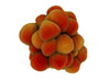 Microscopic view of tumor Poster Print
