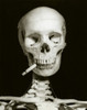Close-up of a human skeleton with a burning cigarette in its mouth Poster Print - Item # VARSAL2553532