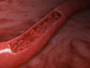 Artery cross section with red blood cell flow Poster Print - Item # VARPSTSTK700106H