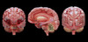 3D rendering of human brain Poster Print - Item # VARPSTSTK701157H