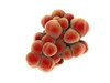 Microscopic view of tumor Poster Print - Item # VARPSTSTK700895H