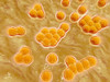 Microscopic view of Methicillin-resistant Staphylococcus aureus Poster Print
