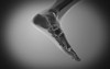 X-ray view of human foot Poster Print - Item # VARPSTSTK700063H