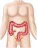 Sectional view of large intestine Poster Print - Item # VARPSTSTK700182H