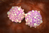 Microscipic view of pancreatic cancer cells Poster Print - Item # VARPSTSTK700891H