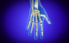 Conceptual image of bones in human hand Poster Print - Item # VARPSTSTK700070H