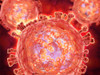 Cluster of HIV virus. HIV is the human immunodeficiency virus that can lead to acquired immune deficiency syndrom, or AIDS. Poster Print - Item # VARPSTSTK700422H