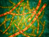Microscopic view of Anthrax. Anthrax is an acute disease caused by the bacterium Bacillus anthracis. Most forms of the disease are lethal, and it affects both humans and animals Poster Print - Item # VARPSTSTK700388H